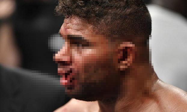 Alldaynews.gr Απίστευτη γροθιά σε αγώνα πυγμαχίας – Του έσκισε όλο το στόμα (ΠΟΛΥ ΣΚΛΗΡΟ VIDEO)