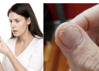 Φάτε αυτό αν έχετε: απώλεια μαλλιών, εύθραυστα νύχια ή αν δεν κοιμάστε καλά