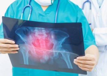 Καρκίνος – συμπτώματα: Μην αμελήσετε ποτέ αυτά τα πέντε “ανύποπτα” σημάδια