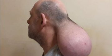 Φυλακές Νιγρίτας: Κρατούμενος έβγαλε δεύτερο κεφάλι![video]