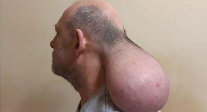 Φυλακές Νιγρίτας: Κρατούμενος έβγαλε δεύτερο κεφάλι![video]