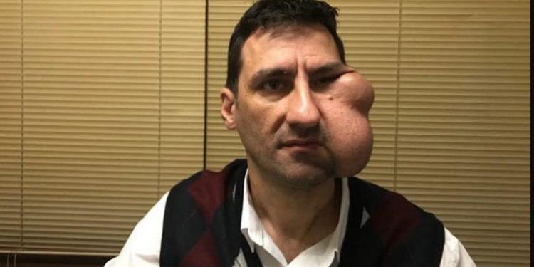 Σοκάρει η εικόνα του Θανάση Συρόπουλου