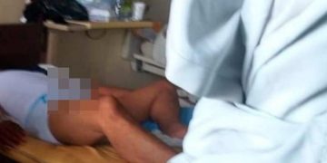 Πήρε διεγερτικό για ταύρους και βρέθηκε στο νοσοκομείο με τριήμερη στύση