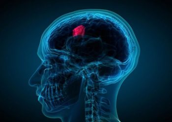 Όγκος στο κεφάλι: Πώς θα τον καταλάβετε – Ποιοι κινδυνεύουν