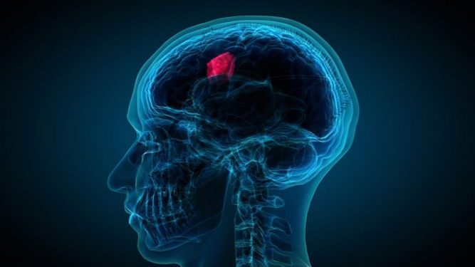 Alldaynews.gr Όγκος στο κεφάλι: Πώς θα τον καταλάβετε – Ποιοι κινδυνεύουν