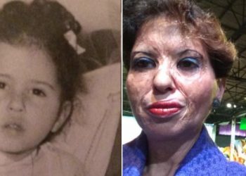 Καλλιόπη Αθανασιάδη: Ήταν ένα από τα «καμένα παιδιά» στο σχολικό του τρόμου -50 χρόνια μετά στέλνει ένα δυνατό μήνυμα