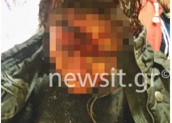 Δράκος της Αθήνας: Μαρτυρία ΣΟΚ 40χρονης-Με στρίμωξε και με ενα μαχαίρι με…[ΣΚΛΗΡΕΣ ΕΙΚΟΝΕΣ]