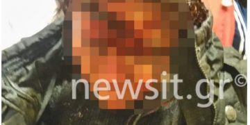 Δράκος της Αθήνας: Μαρτυρία ΣΟΚ 40χρονης-Με στρίμωξε και με ενα μαχαίρι με…[ΣΚΛΗΡΕΣ ΕΙΚΟΝΕΣ]