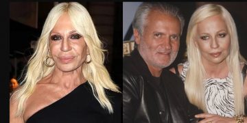 Alldaynews.gr Αλέγκρα Βερσάτσε: Η άγνωστη ζωή της χρυσής κληρονόμου, η κατάθλιψη και η σωματική δυσμορφία