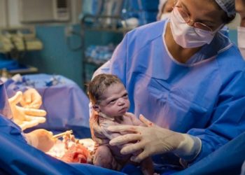 Η Απίστευτη γκριμάτσα εκνευρισμού του νεογέννητου στον μαιευτήρα[photo]