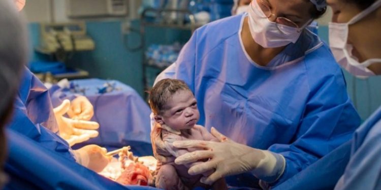 Η Απίστευτη γκριμάτσα εκνευρισμού του νεογέννητου στον μαιευτήρα[photo]