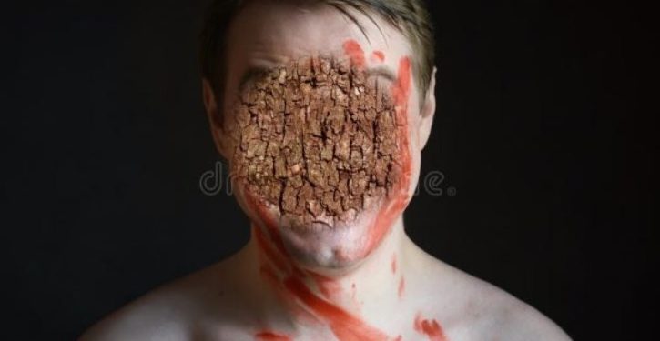 Alldaynews.gr Πάτρα: Θρίλερ για γυναίκα! Ο “πρώην” εμφανιζόταν μπροστά της με αίματα στο πρόσωπο!