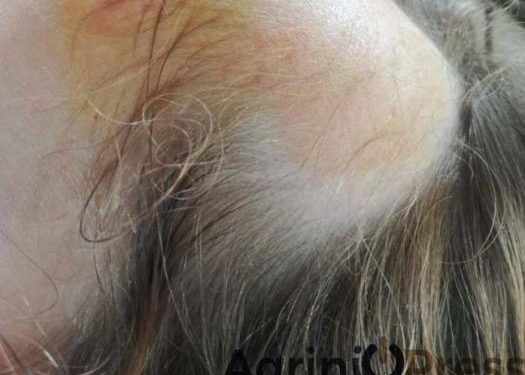 Alldaynews.gr Σοκαριστικό ατύχημα σε νηπιαγωγείο! Ξεριζώθηκαν τα μαλλιά 5χρονης (pics)