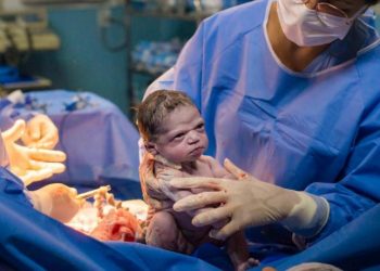 Viral: Αυτό το κοριτσάκι είναι το πιο… νευριασμένο νεογέννητο του κόσμου! (pic)