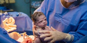 Alldaynews.gr Viral: Αυτό το κοριτσάκι είναι το πιο… νευριασμένο νεογέννητο του κόσμου! (pic)