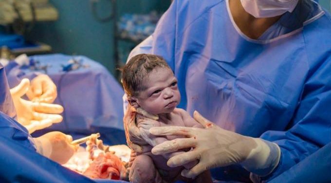 Alldaynews.gr Viral: Αυτό το κοριτσάκι είναι το πιο… νευριασμένο νεογέννητο του κόσμου! (pic)