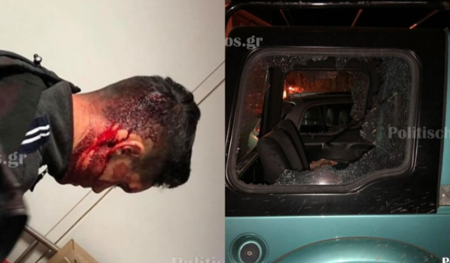 Χίος: ΜΑΤ έδεσαν πισθάγκωνα πολίτες και τους κοπανούσαν στο κεφάλι – «Ήρθατε στο σπίτι μας και μας γαμ#@τε, θα σας αφήσουμε στον τόπο»! (pics, video)