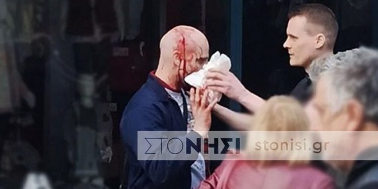 Alldaynews.gr Χτύπησαν Γερμανό ακροδεξιό στη Μυτιλήνη – “Θα σας κάνουμε ό,τι σας κάναμε στα Καλάβρυτα” (pics)