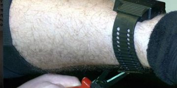 Alldaynews.gr Κορονοϊός: Με βραχιολάκι θα επιτηρούνται οι θετικοί στον ιό-Νέα αυστηρά μέτρα στην Κύπρο