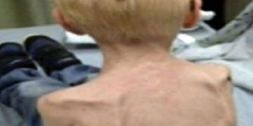 Τραγικό! H αστυνομία βρήκε ένα 5χρονο που ήταν τόσο υποσιτισμένος που έτρωγε το δικό του χέρι