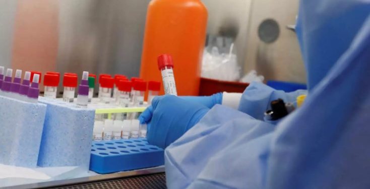 Κορονοϊός: Καλή Είδηση! Σημαντική ανακάλυψη για το φάρμακο του