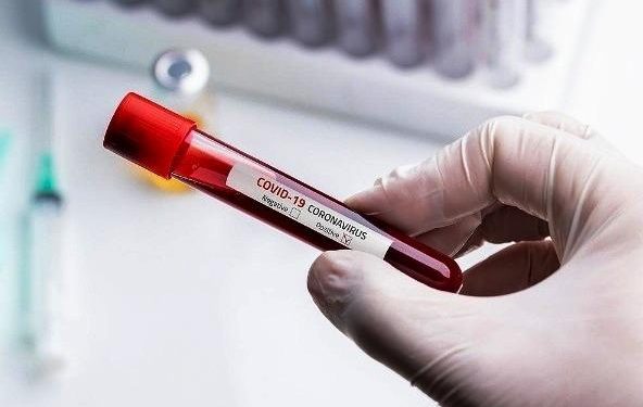 Alldaynews.gr Κορωνοϊός: Ελπιδοφόρα μηνύματα από τον ΠΟΥ – Οι 4 πιο υποσχόμενες θεραπείες κατά του ιού