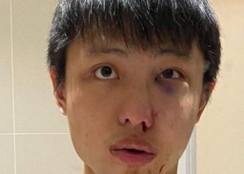 Παράνοια στο Λονδίνο: Του είπε «δεν θέλω τον κορωνοϊό σου» και τον σάπισε στο ξύλο (pic)