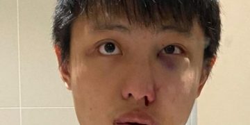 Παράνοια στο Λονδίνο: Του είπε «δεν θέλω τον κορωνοϊό σου» και τον σάπισε στο ξύλο (pic)