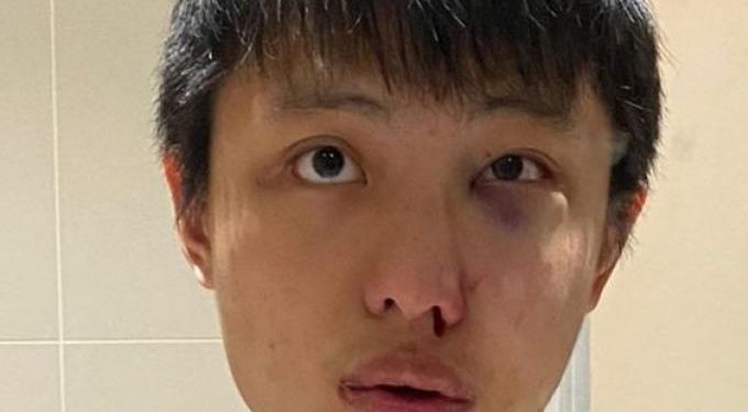 Παράνοια στο Λονδίνο: Του είπε «δεν θέλω τον κορωνοϊό σου» και τον σάπισε στο ξύλο (pic)