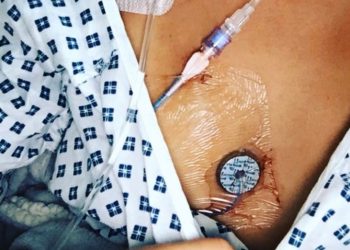 Τραγικό! «Είμαστε στα χέρια του Θεού»- Η έκκληση των ανθρώπων με πνευμονική υπέρταση στο Υπουργείο Υγείας