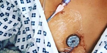 Alldaynews.gr Τραγικό! «Είμαστε στα χέρια του Θεού»- Η έκκληση των ανθρώπων με πνευμονική υπέρταση στο Υπουργείο Υγείας