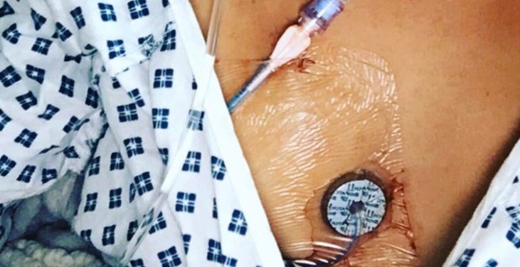 Alldaynews.gr Τραγικό! «Είμαστε στα χέρια του Θεού»- Η έκκληση των ανθρώπων με πνευμονική υπέρταση στο Υπουργείο Υγείας