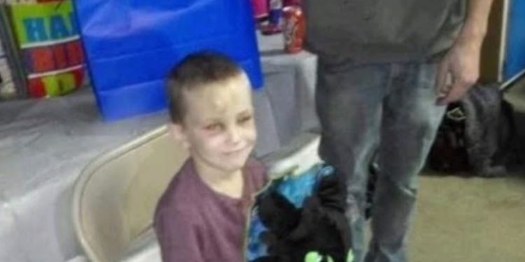 Έκοψε τα γεννητικά όργανα του 5χρονου εγγονού της και τον Κατακρεούργησε επειδή έπαιζε με αυτά[photos]