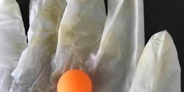 Alldaynews.gr Θρίλερ με 5χρονο παιδί που κατάπιε μπαλάκι