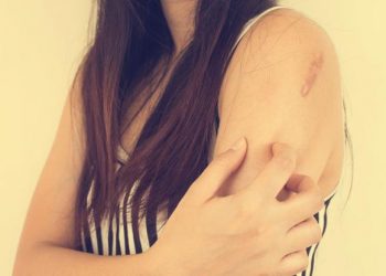 Ακόμα μία αρνητική επίπτωση του κορωνοϊού στον οργανισμό: Επιδεινώνει την ατοπική δερματίτιδα