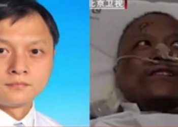 Απίστευτη επιπλοκή: Μαύρισε το δέρμα δύο Κινέζων γιατρών που προσβλήθηκαν από κορωνοϊό (Video)