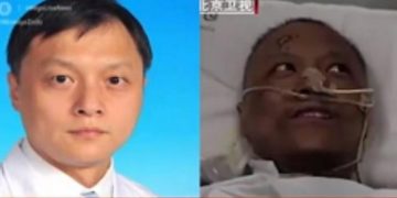 Alldaynews.gr Απίστευτη επιπλοκή: Μαύρισε το δέρμα δύο Κινέζων γιατρών που προσβλήθηκαν από κορωνοϊό (Video)