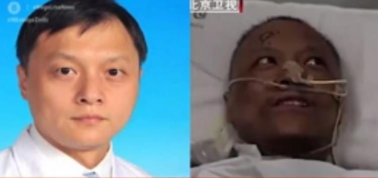 Alldaynews.gr Απίστευτη επιπλοκή: Μαύρισε το δέρμα δύο Κινέζων γιατρών που προσβλήθηκαν από κορωνοϊό (Video)