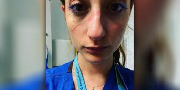 Alldaynews.gr Μια Ελληνίδα γιατρός στο Βρετανικό ΕΣΥ(NHS) μιλάει για τον “πόλεμο” και θέλει να σταθούμε δίπλα της…