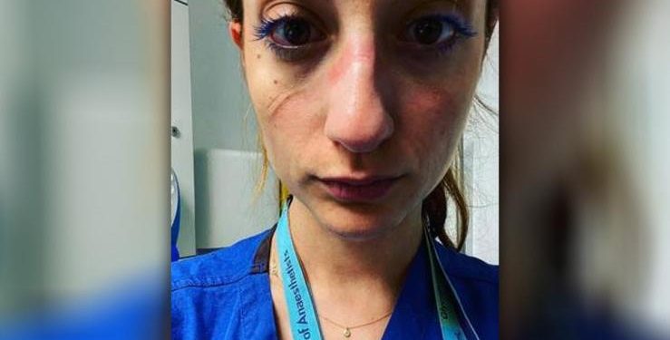 Alldaynews.gr Μια Ελληνίδα γιατρός στο Βρετανικό ΕΣΥ(NHS) μιλάει για τον “πόλεμο” και θέλει να σταθούμε δίπλα της…