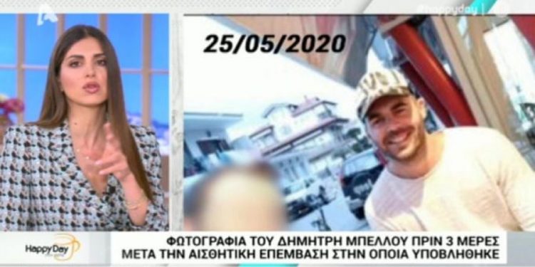 Alldaynews.gr Ο Μπέλλος έκανε εμφύτευση μαλλιών