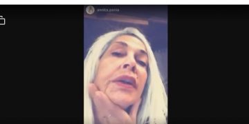 Βίσση: Η καραντίνα και ο πλαστικός χειρουργός της Πάνια που κάνει θαύματα![videos]