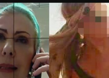 Επίθεση με βιτριόλι: Τρίωρο χειρουργείο για την 34χρονη Ιωάννα – Αφαιρέθηκε το καμένο δέρμα