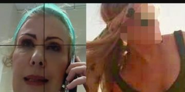 Επίθεση με βιτριόλι: Τρίωρο χειρουργείο για την 34χρονη Ιωάννα – Αφαιρέθηκε το καμένο δέρμα