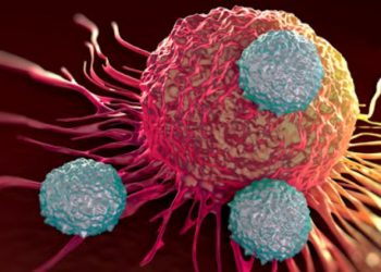 Αθώα συμπτώματα που μπορεί να υποδηλώνουν καρκίνο