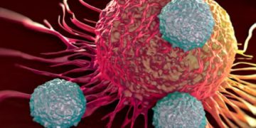 Αθώα συμπτώματα που μπορεί να υποδηλώνουν καρκίνο