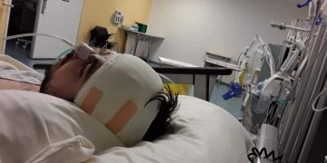 Ελπίδα για τον Ηλία από τη Θεσσαλονίκη! Ξεκινάει θεραπεία πρωτονίων