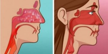 Alldaynews.gr Ξεβουλώστε την μύτη σας μέσα σε 20 δευτερόλεπτα με αυτήν την συνταγή