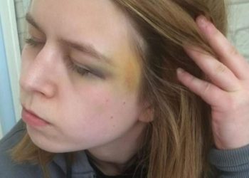 Vegan σάπισε στο ξύλο τη φίλη του γιατί μύριζε …κρέας