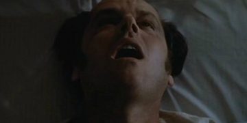 Ο νομπελίστας ψυχίατρος που εφάρμοσε τη λοβοτομή – Τα διάσημα θύματά του (pics)